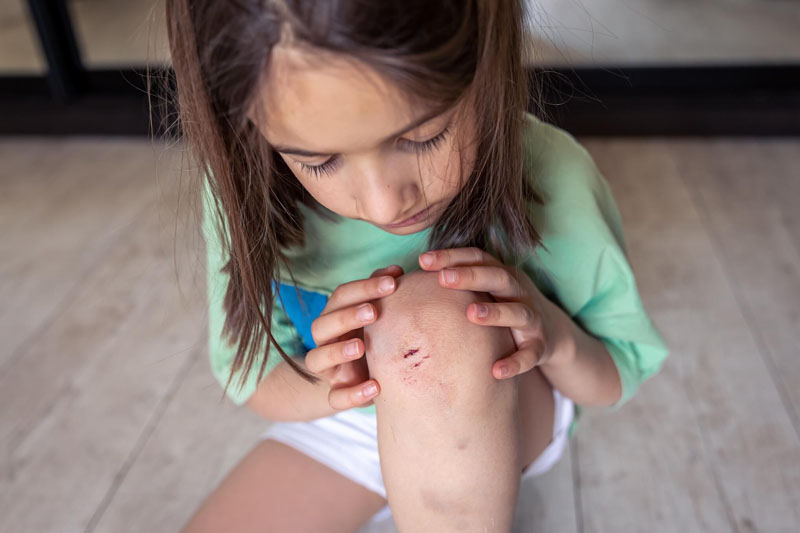 Tips for Keeping Children's Wounds Clean and Protected